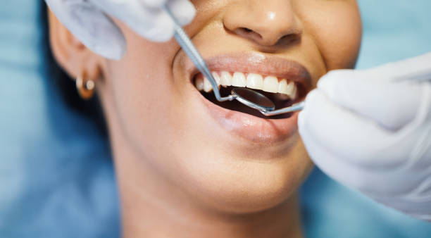 Best Chipped Tooth Repair Near Me  in Dansville, NY