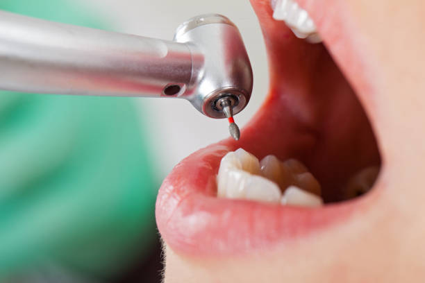 Best Tooth Infection Emergency Dentist  in Dansville, NY